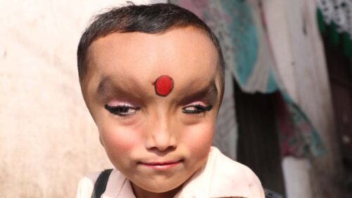 Boy With Mystery Condition Is Worshipped As A God