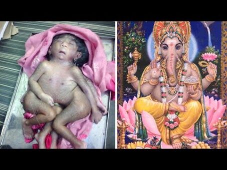 Hindu Elephant God Reborn as Eight-Limbed Baby