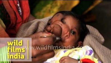 Baby girl born with a trunk worship as Lord Ganesha
