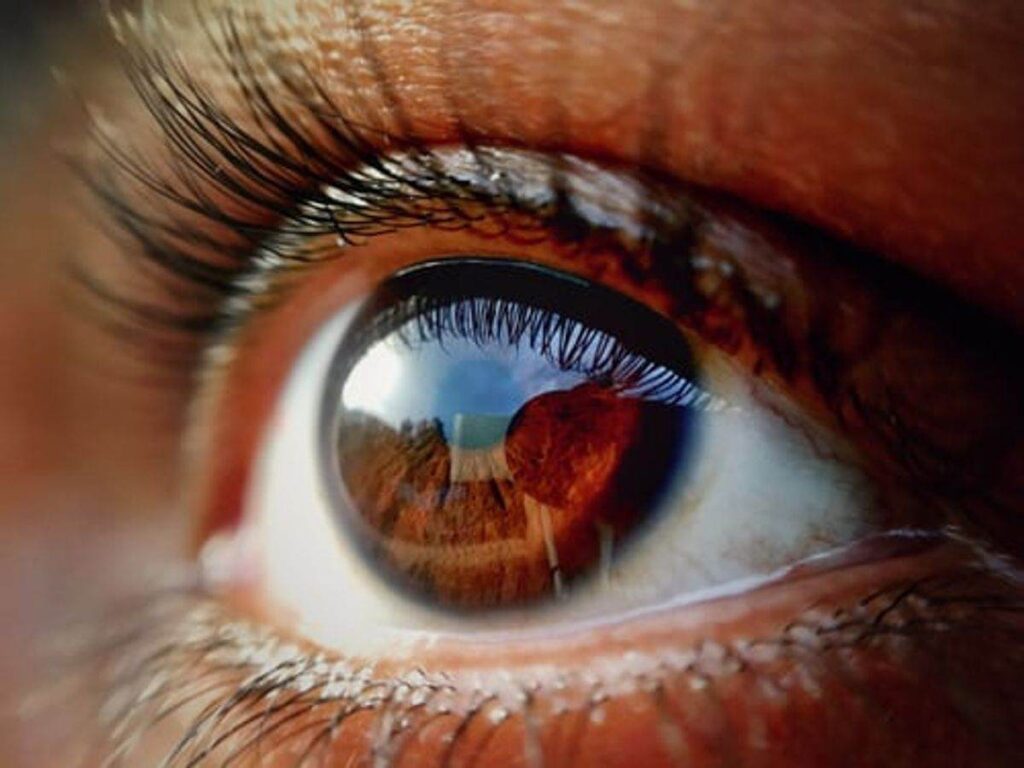 Different Designs Of Contact Lenses Available 1 prescription circle lenses