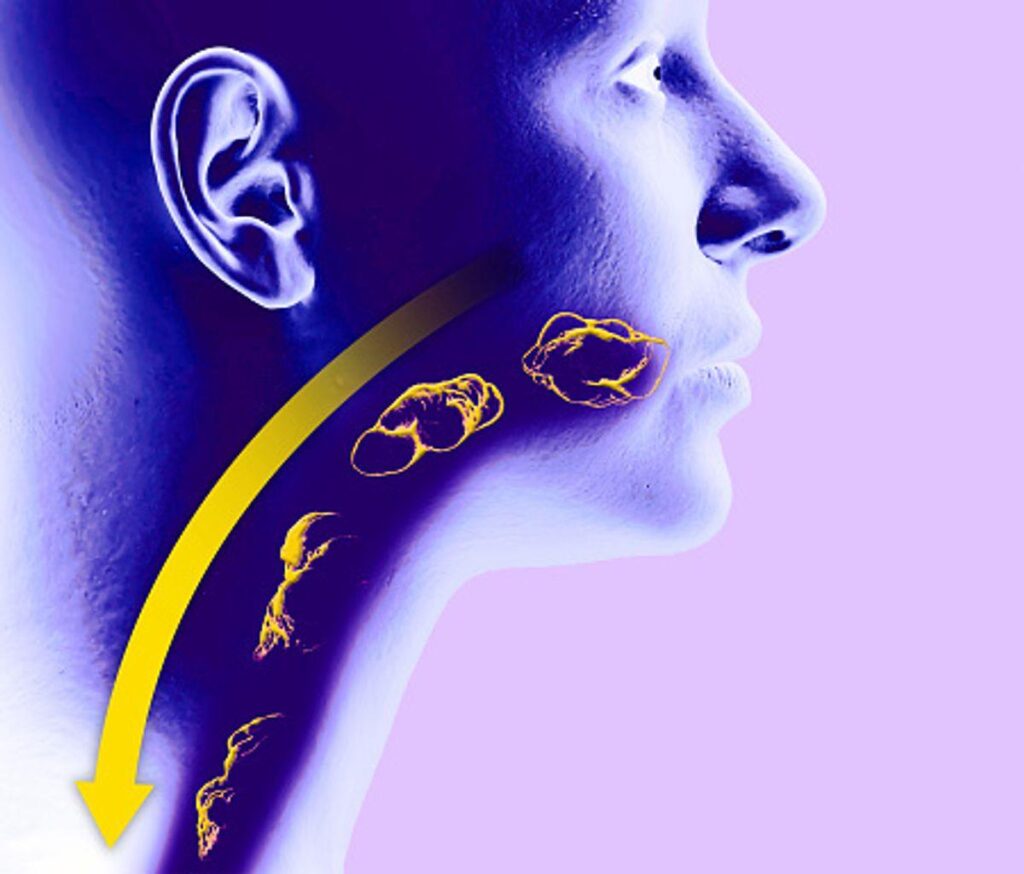 Understanding Dysphagia: A Complete Guide to Symptoms and Treatment 1 feeling stuck as it goes