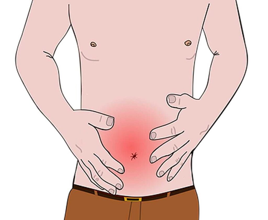How to Banish Constipation