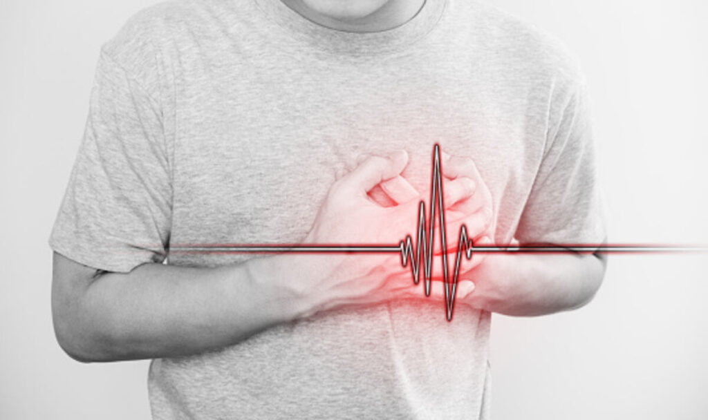 Cardiovascular Disease and Sudden Cardiac Arrest 1 cardiovascular disease