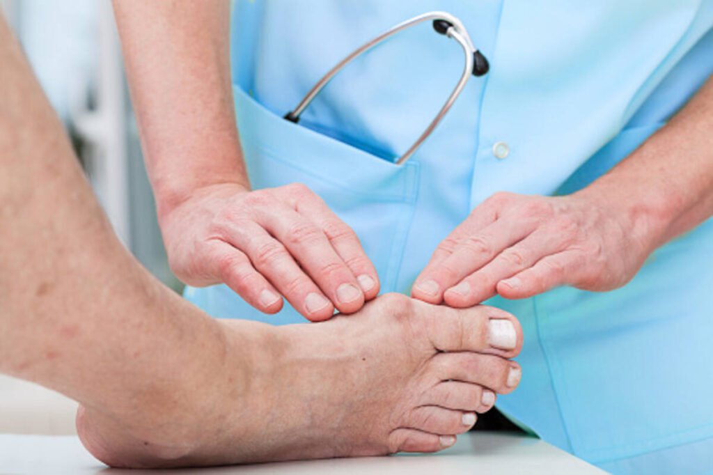 what is a bunion