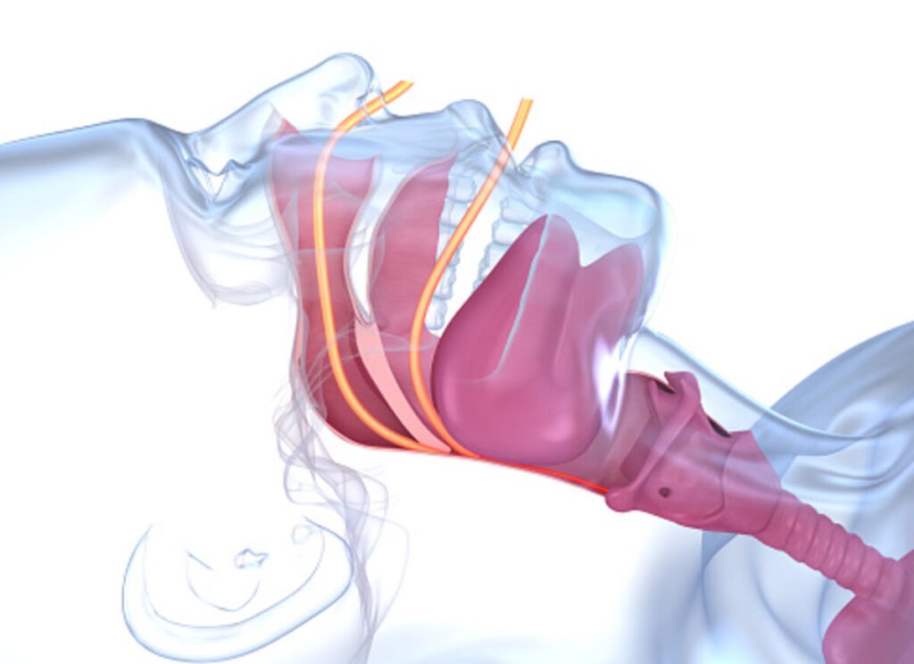 4 Signs That You Need to See a Snoring Specialist Immediately 1 snoring specialist