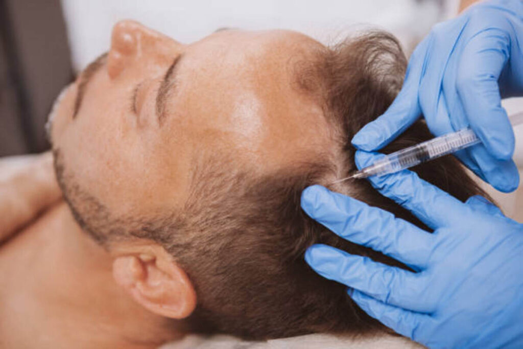 Knowing Hair Loss: Men's Treatment Options 1 Knowing Hair Loss Men's Treatment Options